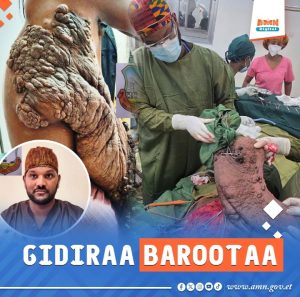 Read more about the article Gidiraa waggaa 13, wal’aansa baqaqsanii yaaluu sa’aatii 4’n