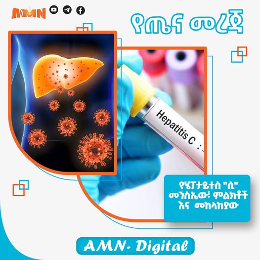Read more about the article የሄፓታይተስ “ሲ” መንስኤው፣ ምልክቶች እና መከላከያው