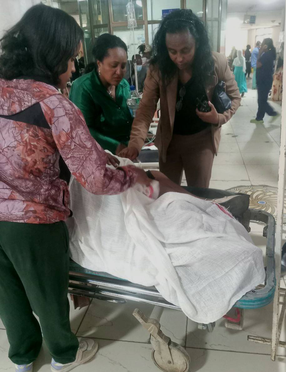 Read more about the article በጉለሌ ክፍለ-ከተማ በደረሰ የመኪና አደጋ 18 ሰዎች ላይ ጉዳት ደረሰ