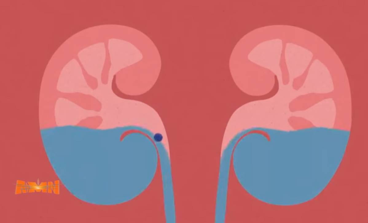 You are currently viewing የሽንት ኢንፌክሽን ህመም እና መከላከያ መንገዱ