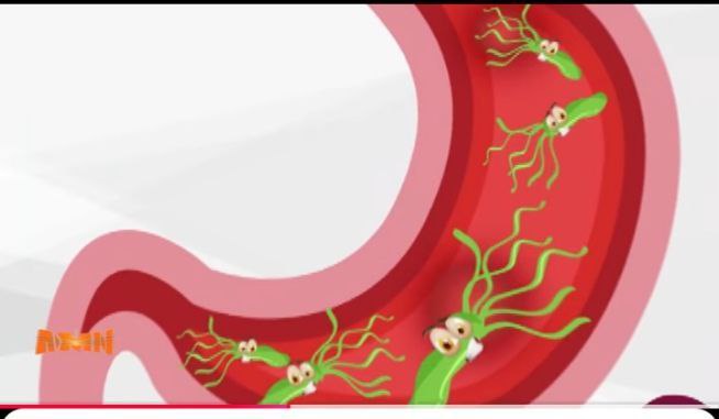 You are currently viewing በህፃናት ላይ የጨጓራ በሽታ እንዴት ይከሰታል? ህክምናውስ?