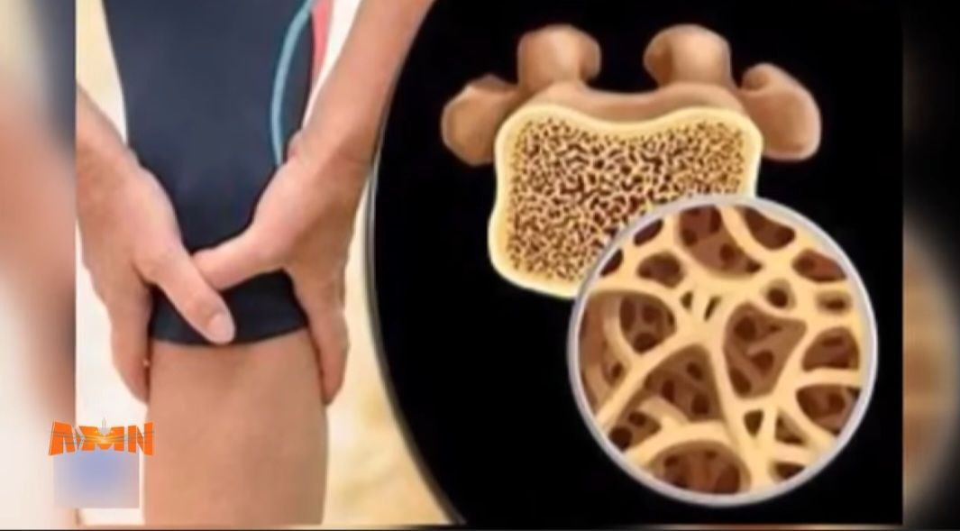 You are currently viewing የአጥንት ቲቢ በሽታ ምንድነዉ?