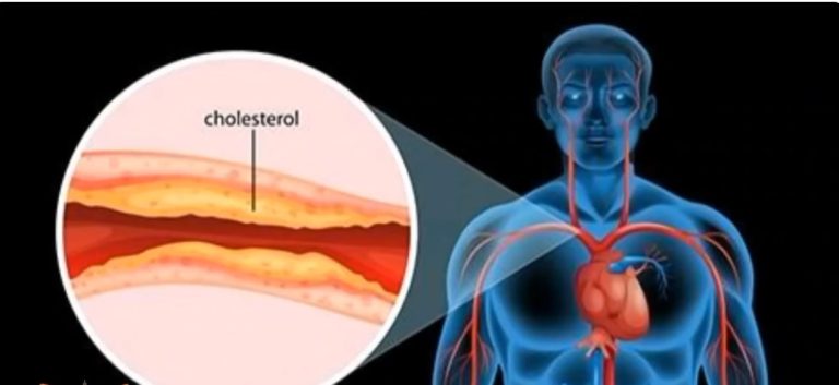 598836949_1324830166357020_3864221542056370688_n